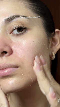 DR MELAXIN TRATAMIENTO KOREANO FACIAL 2x1